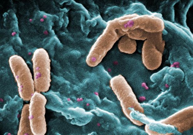 Cepa de bacteria pseudomona detectada en otros pacientes.